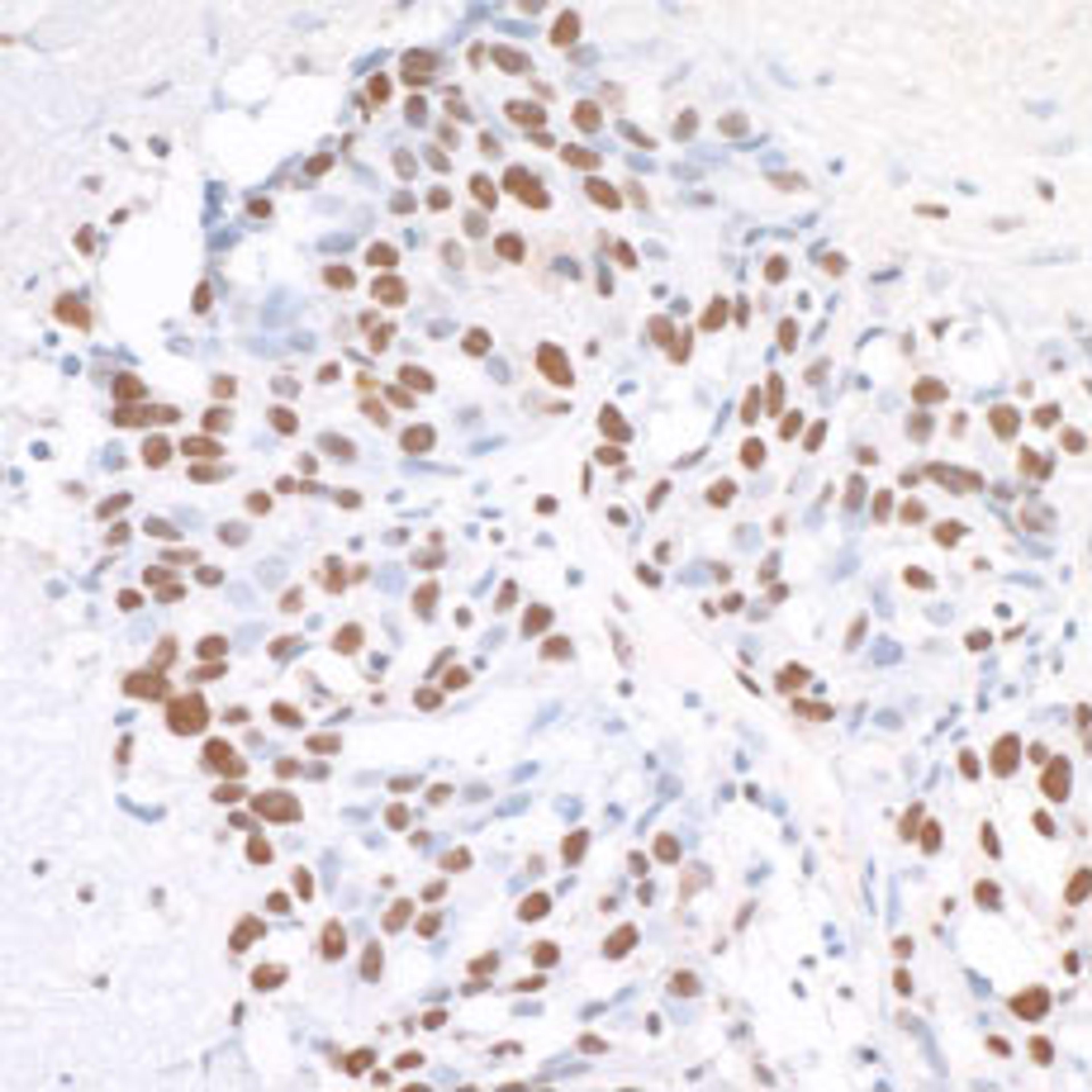 Detection of human CPSF160 by immunohistochemistry.