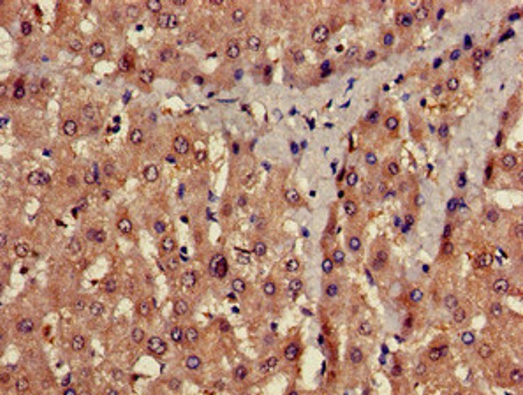 Immunohistochemistry of paraffin-embedded human liver tissue using CSB-PA018742LA01HU at dilution of 1:100