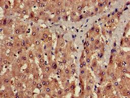 Immunohistochemistry of paraffin-embedded human liver tissue using CSB-PA018742LA01HU at dilution of 1:100