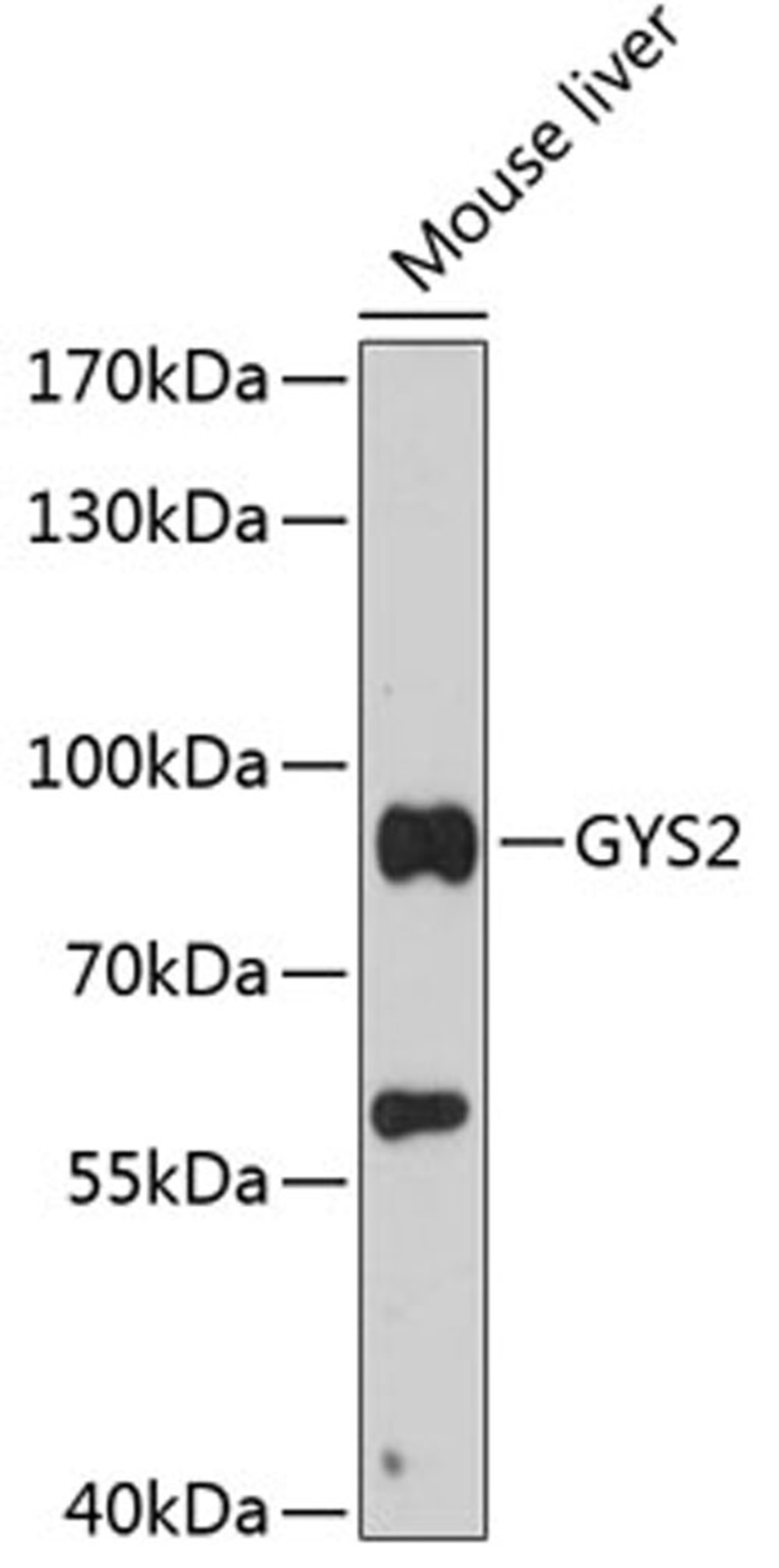 Western blot - GYS2 antibody (A13020)