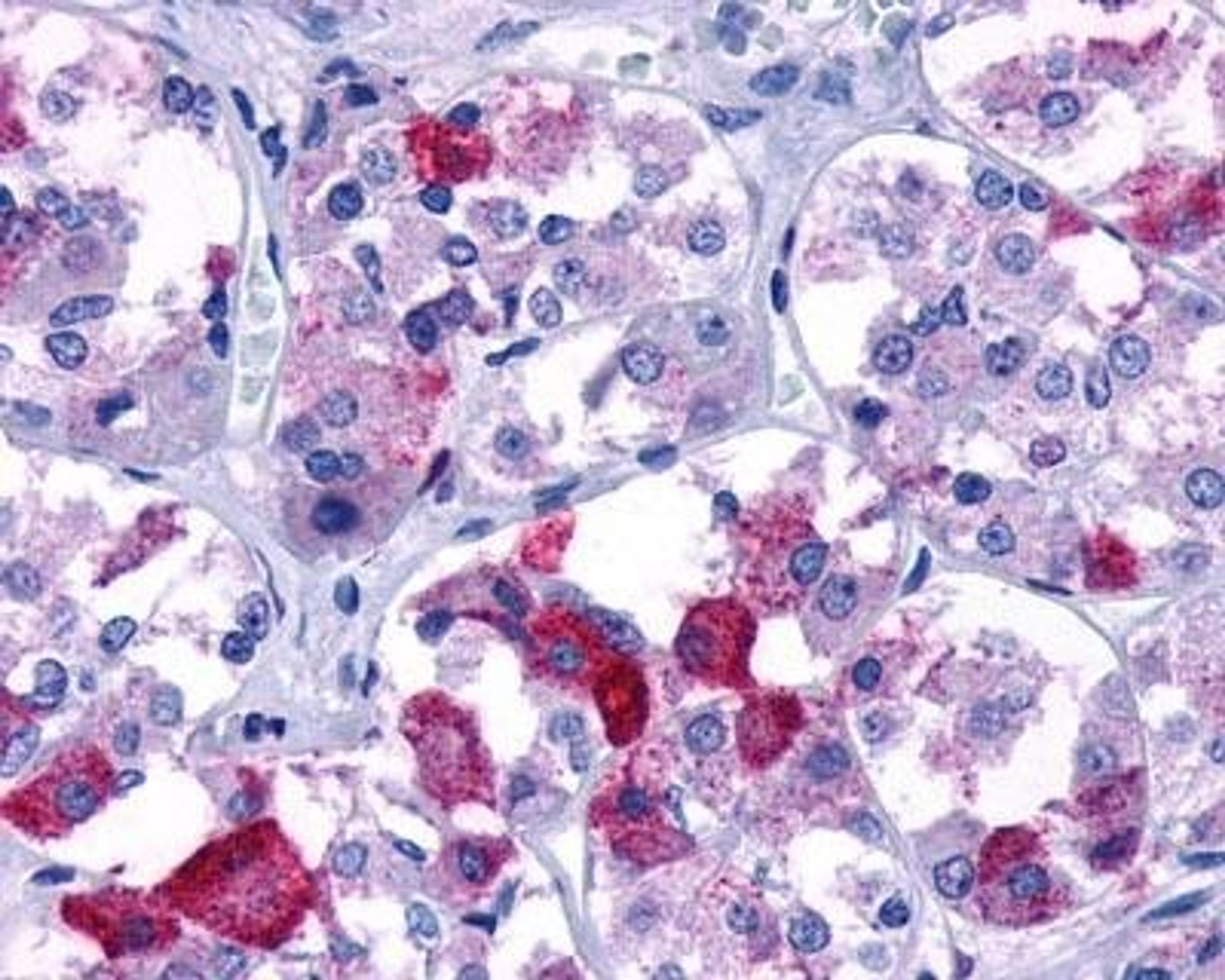 Immunohistochemistry: V1b Vasopressin R/AVPR1B Antibody [NLS266] - Analysis of anti-AVPR1B antibody with brain, pituitary at 4 ug/ml.