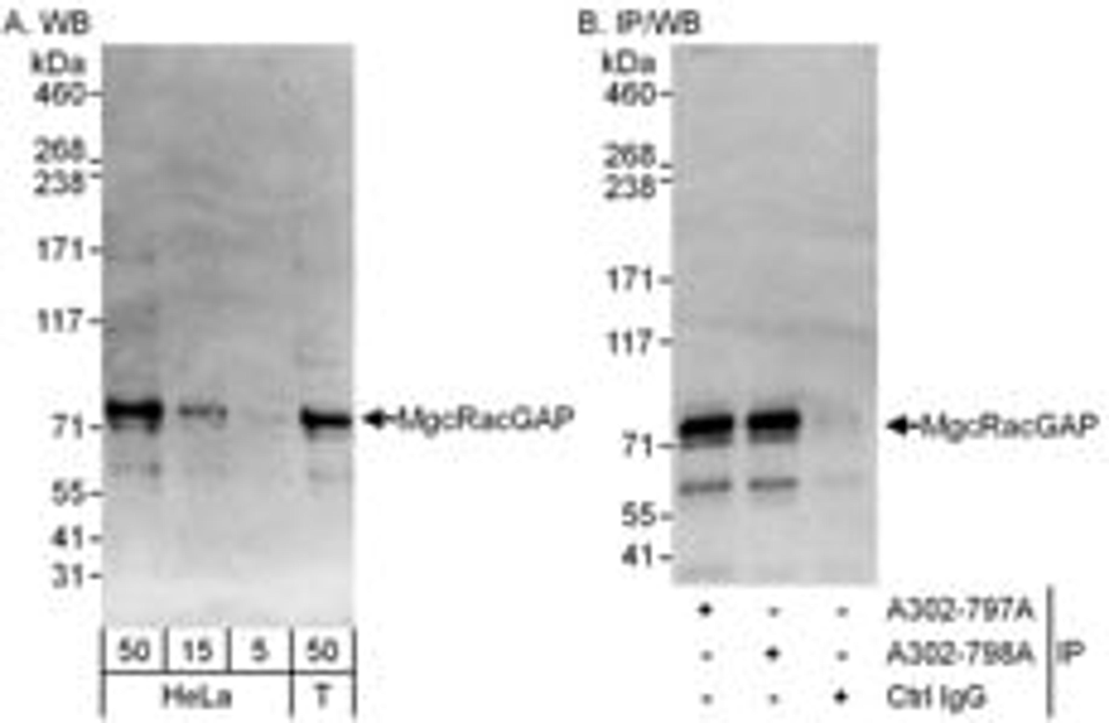 Detection of human MgcRacGAP by western blot and immunoprecipitation.