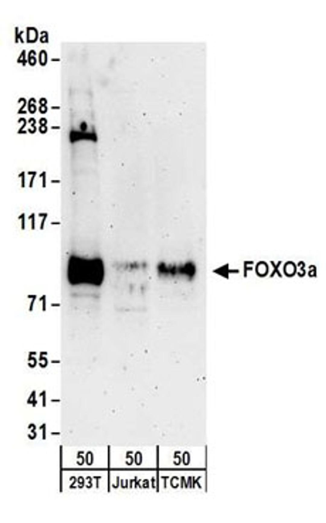 Detection of human and mouse FOXO3a by western blot.