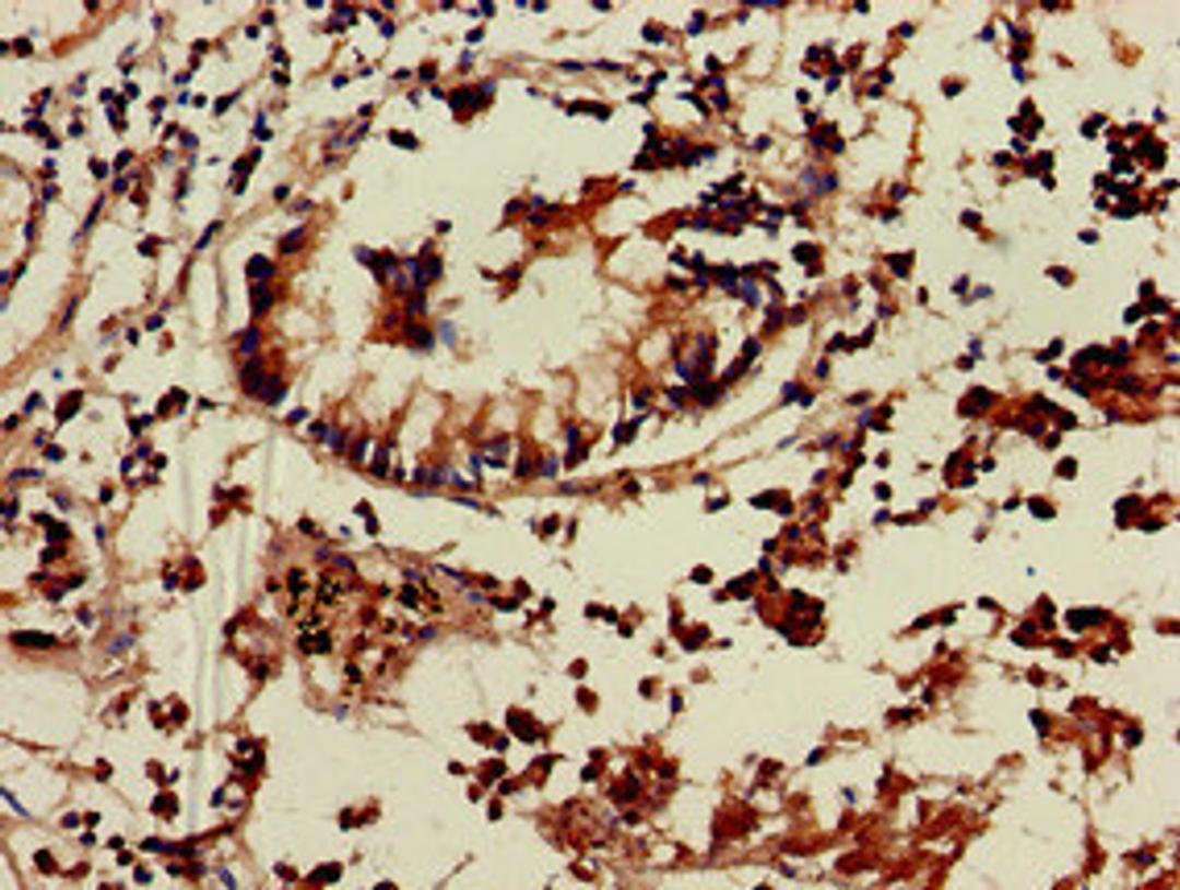 Immunohistochemistry of paraffin-embedded human appendix tissue using CSB-PA023998LA01HU at dilution of 1:100