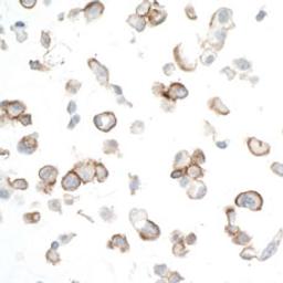 Detection of human CD133 in FFPE OVCAR-4 cells by ICC.