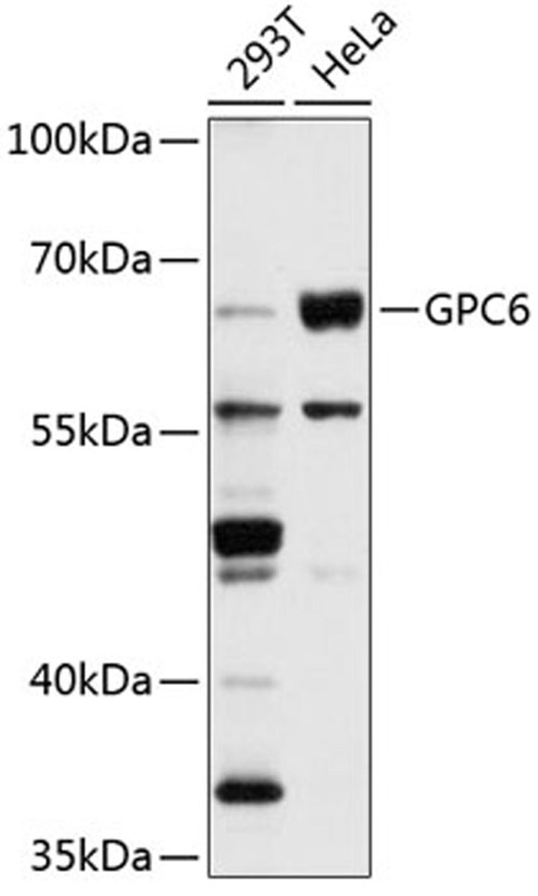 Western blot - GPC6 antibody (A2741)