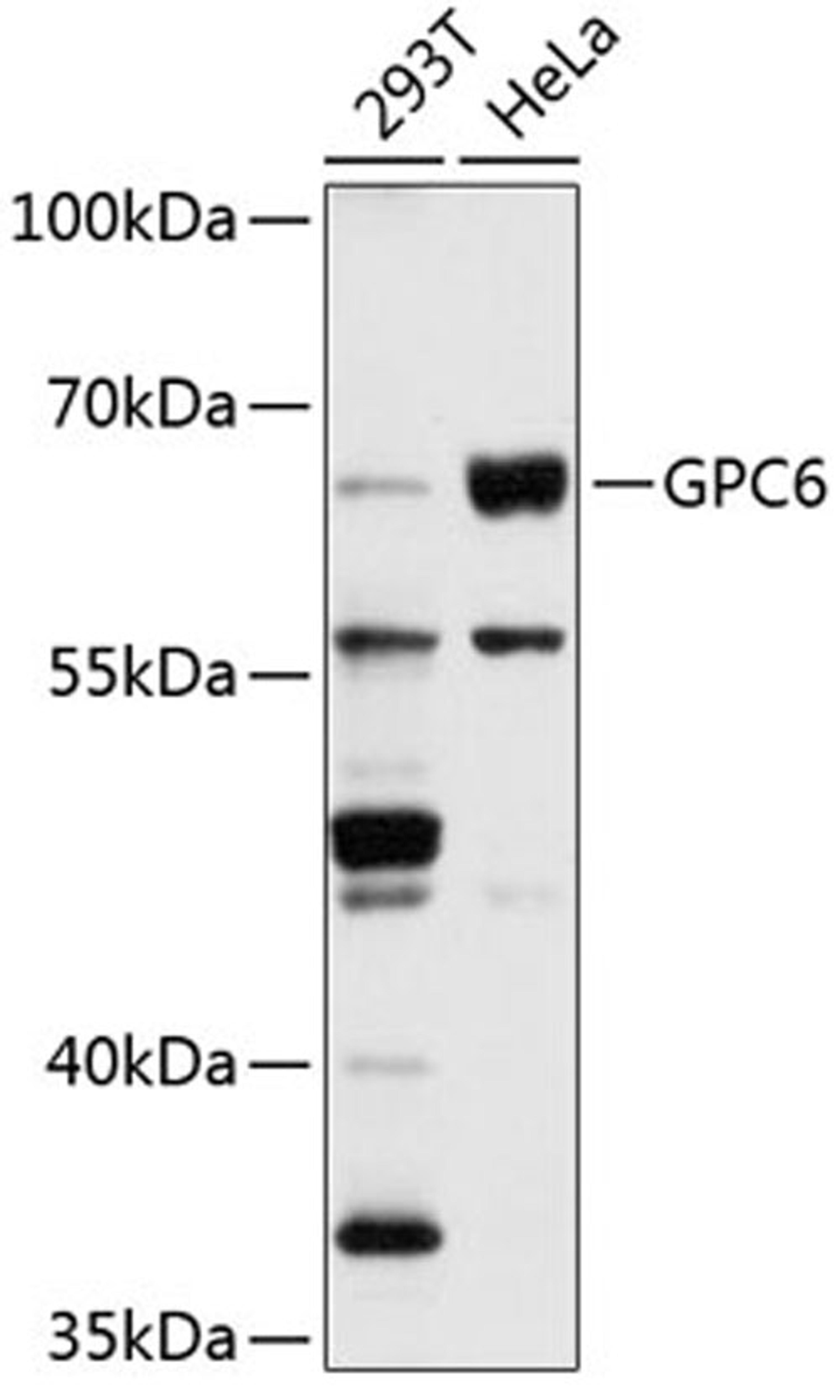 Western blot - GPC6 antibody (A2741)