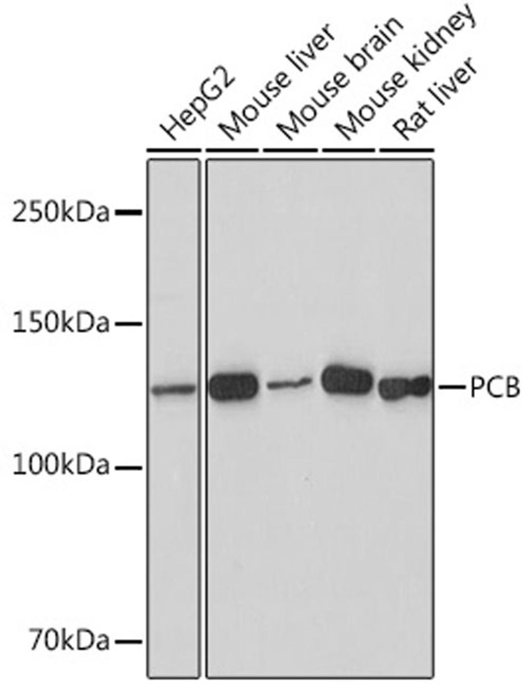 Western blot - PCB Rabbit mAb (A8980)