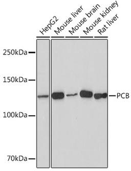 Western blot - PCB Rabbit mAb (A8980)