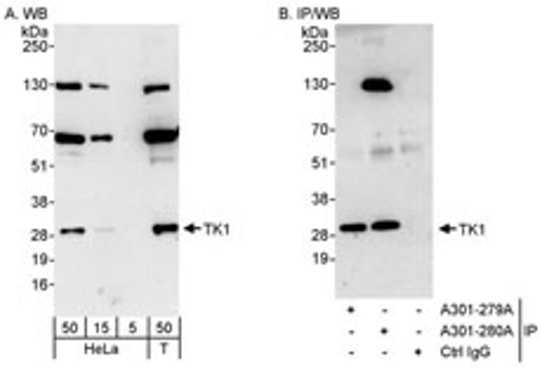 Detection of human TK1 by western blot and immunoprecipitation.