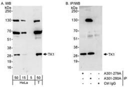 Detection of human TK1 by western blot and immunoprecipitation.