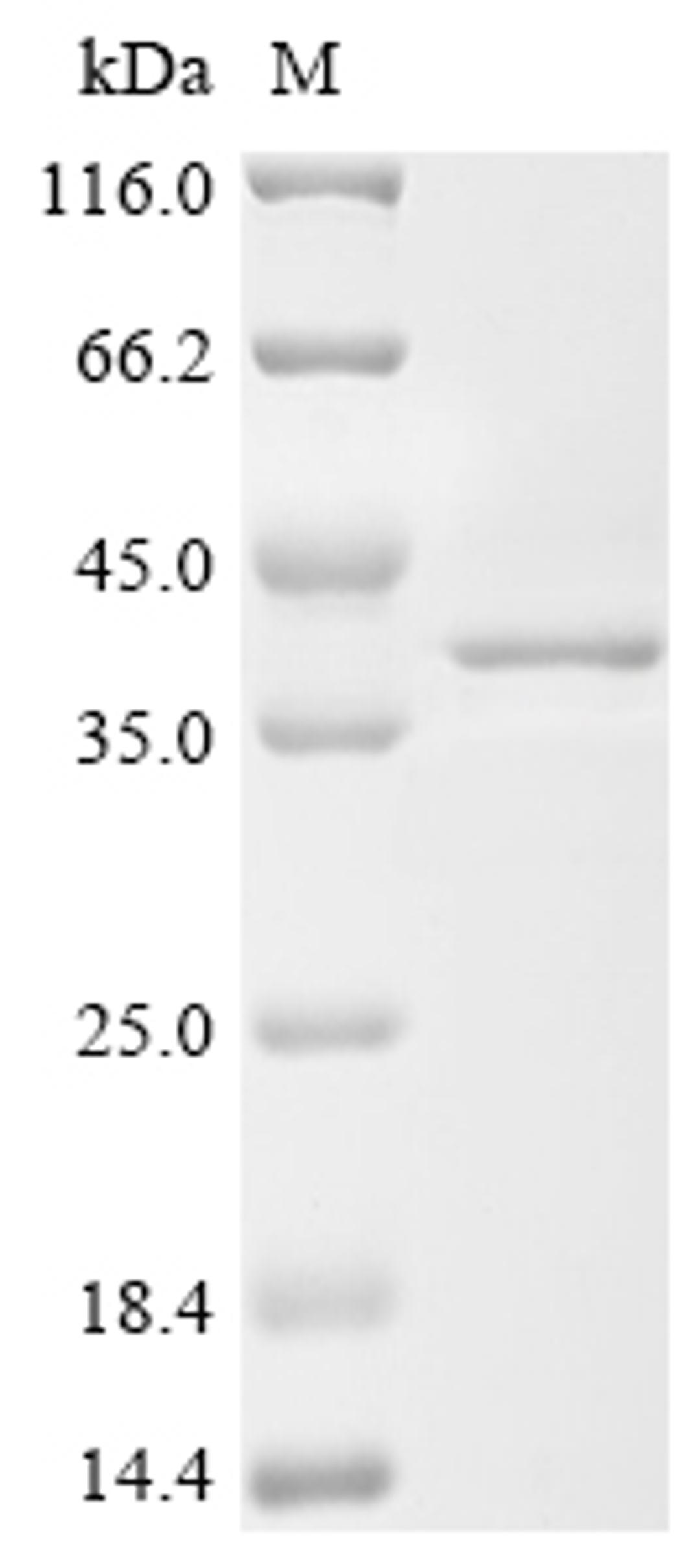 (Tris-Glycine gel) Discontinuous SDS-PAGE (reduced) with 5% enrichment gel and 15% separation gel.