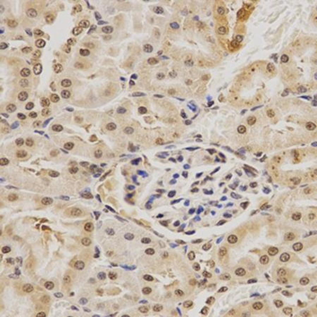 IHC-P image of rat kidney tissue using MDM2 antibody (primary antibody dilution at 1:200)