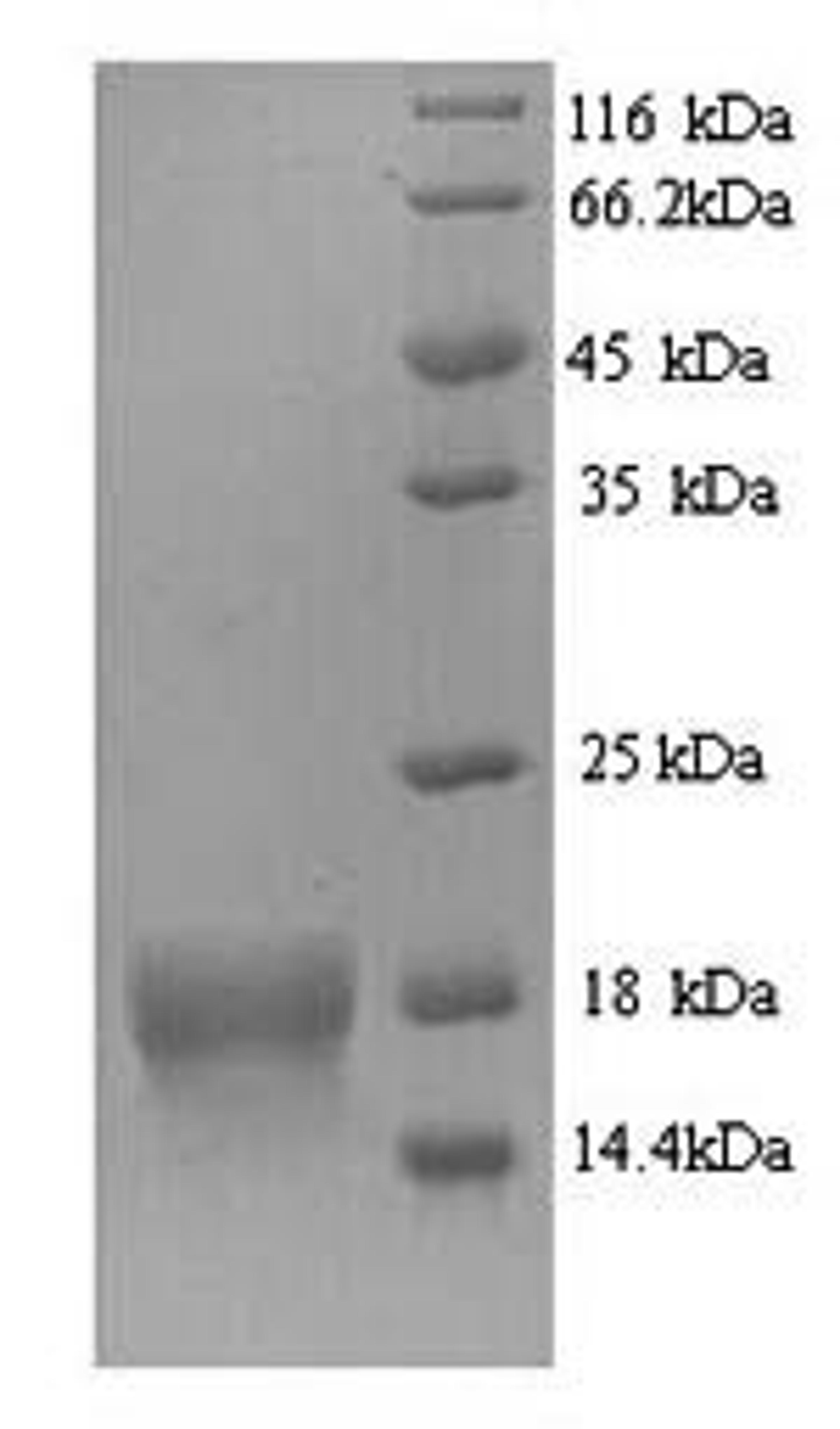 (Tris-Glycine gel) Discontinuous SDS-PAGE (reduced) with 5% enrichment gel and 15% separation gel.