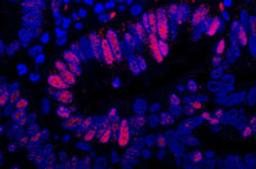 Detection of human MCM3 by immunofluorescence.