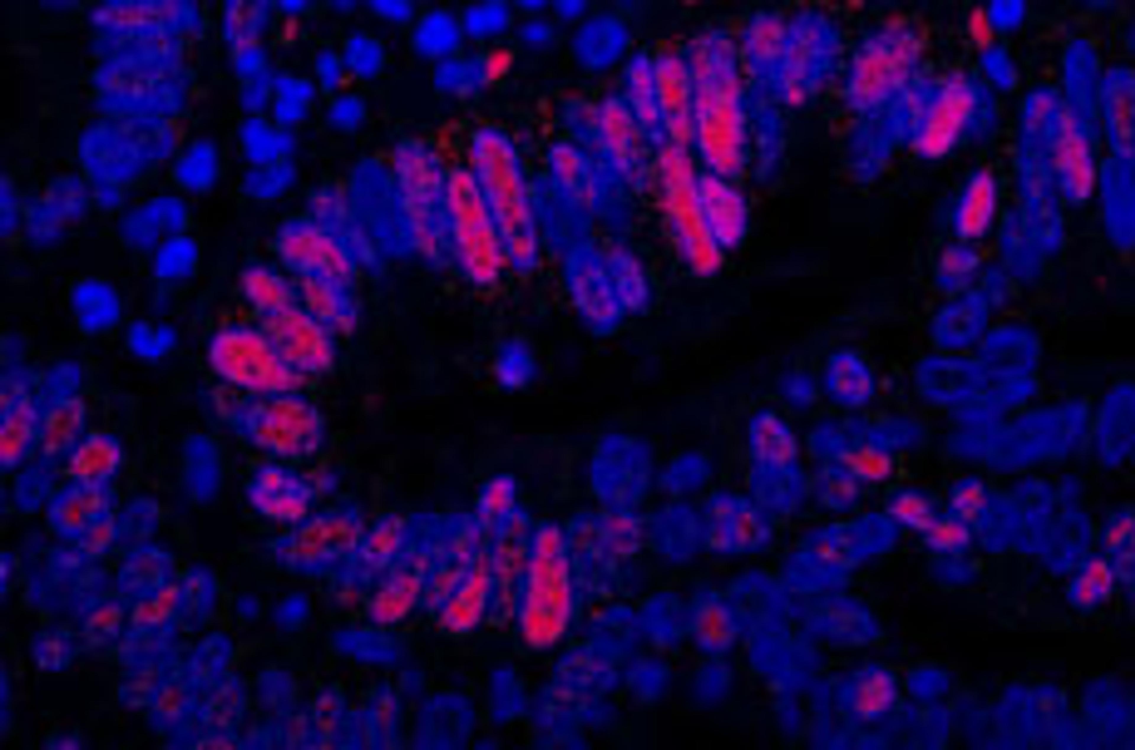 Detection of human MCM3 by immunofluorescence.