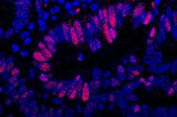 Detection of human MCM3 by immunofluorescence.