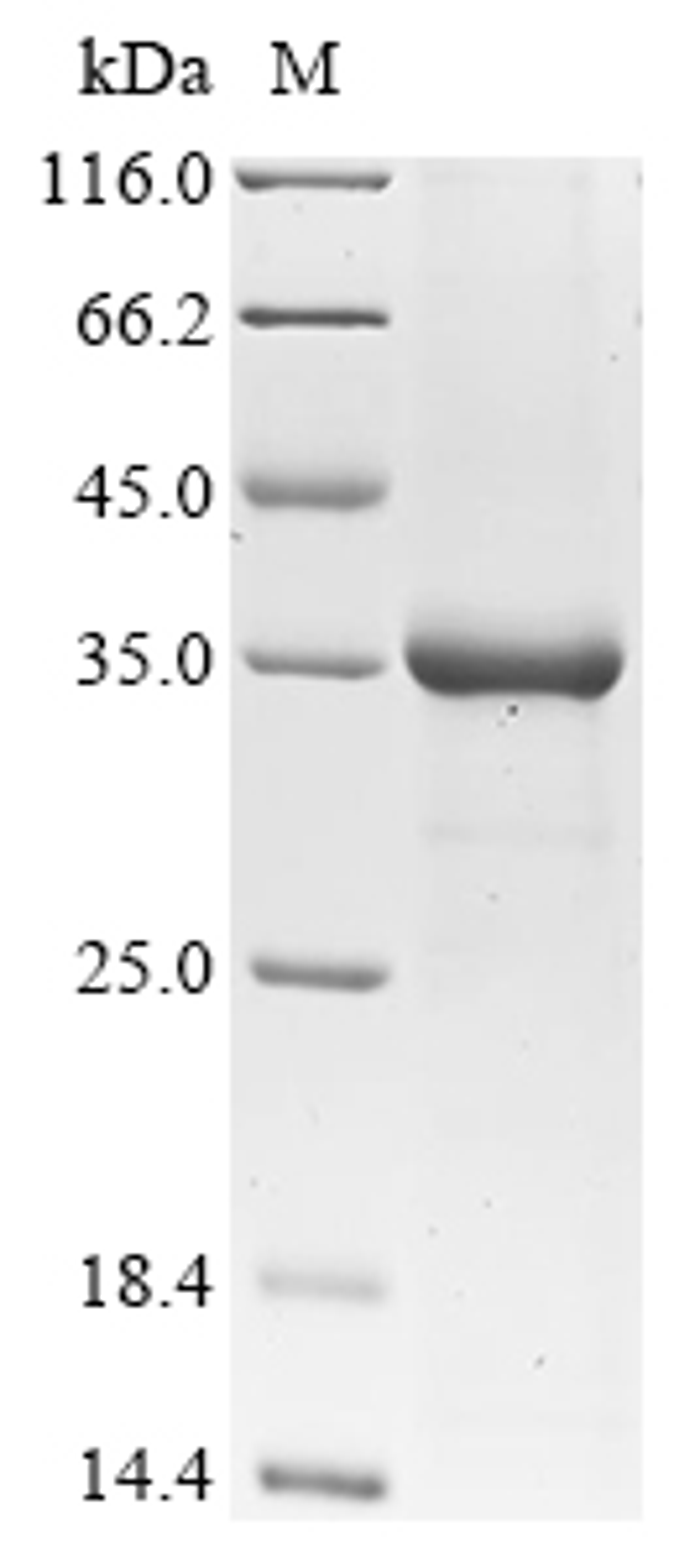 (Tris-Glycine gel) Discontinuous SDS-PAGE (reduced) with 5% enrichment gel and 15% separation gel.