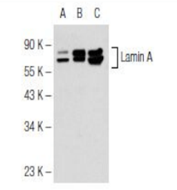 Western blot analysis of non-transfected 293T (Lane 1), transfected 293T (Lane 2), Hs68 (Lane 3) whole cell lysates using Lamin A/C antibody.