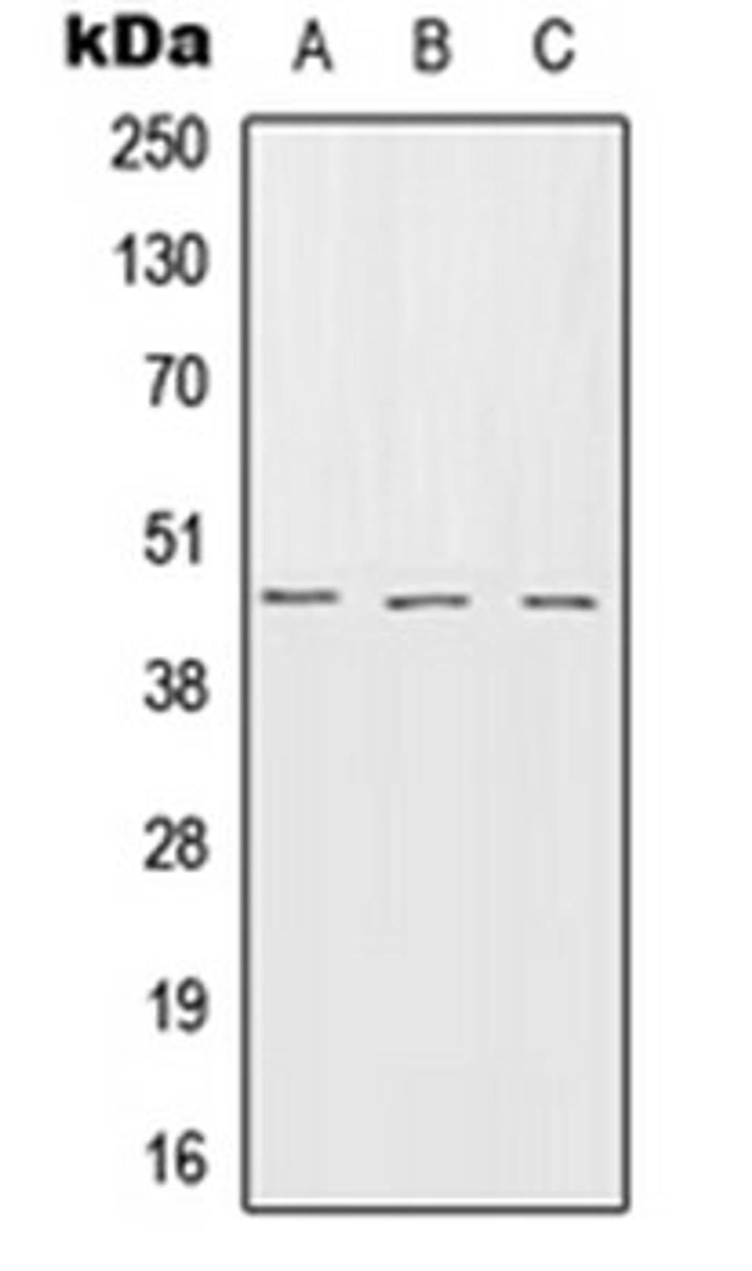 Western blot analysis of HEK293T (Lane 1), SP2/0 (Lane 2), rat brain (Lane 3) whole cell lysates using SERPINB7 antibody