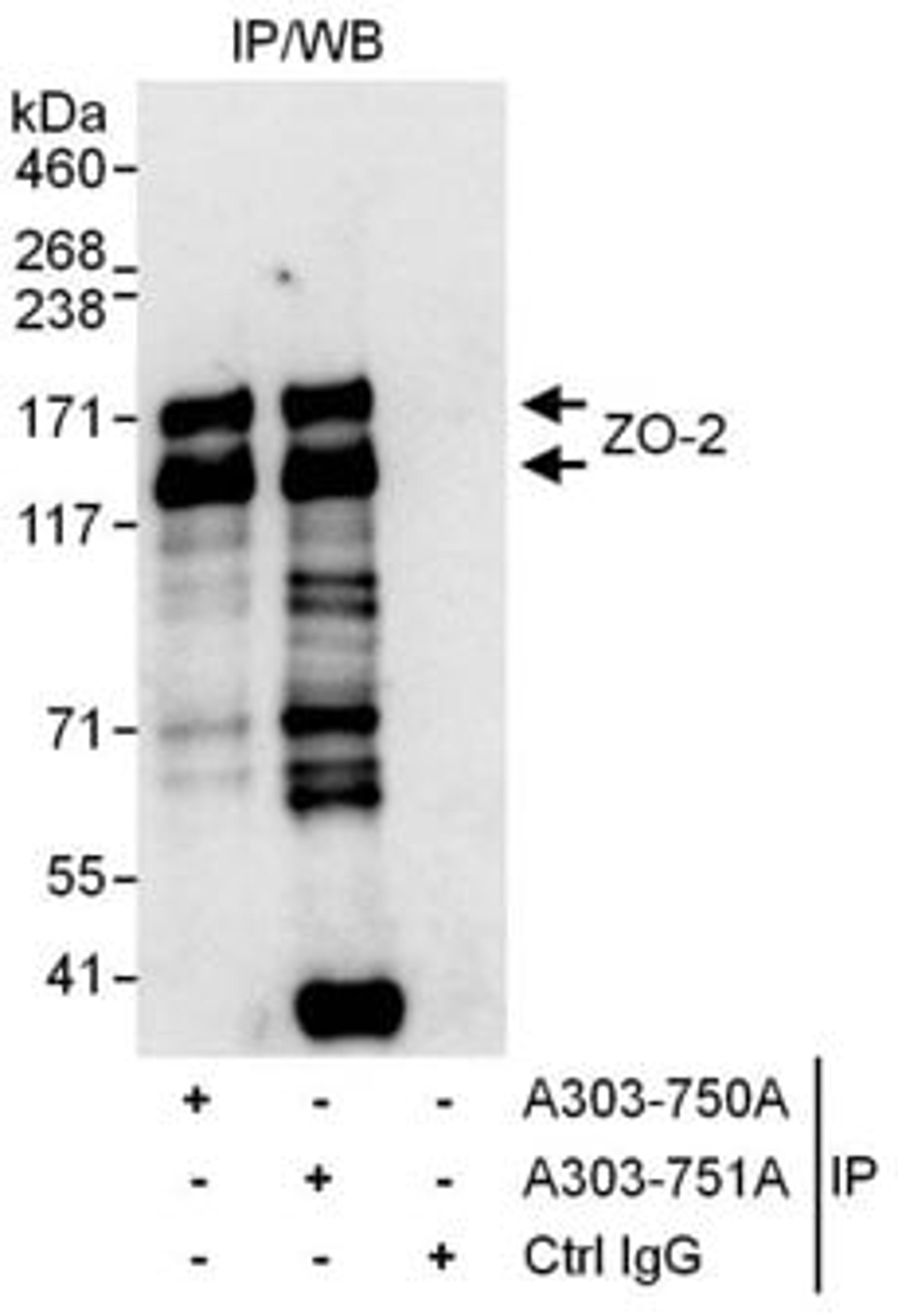 Detection of human ZO-2 by western blot of immunoprecipitates.