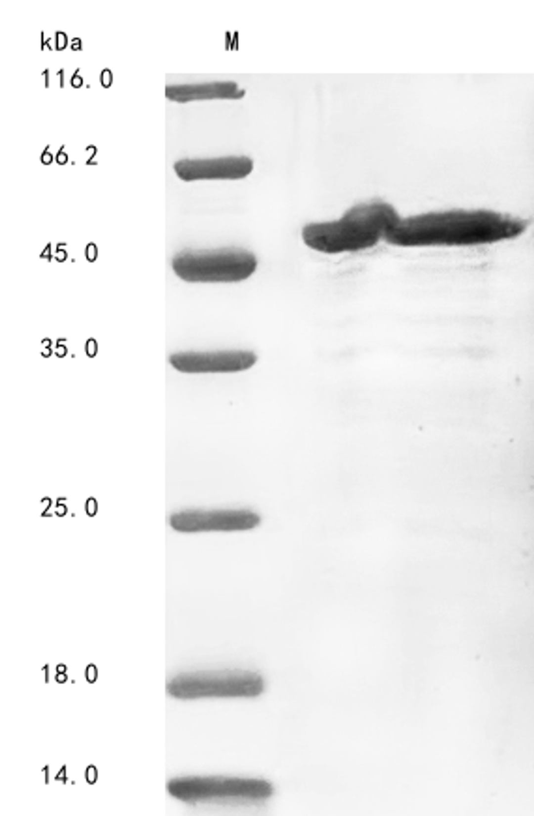 (Tris-Glycine gel) Discontinuous SDS-PAGE (reduced) with 5% enrichment gel and 15% separation gel.