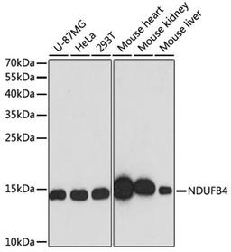 Western blot - NDUFB4 antibody (A13820)