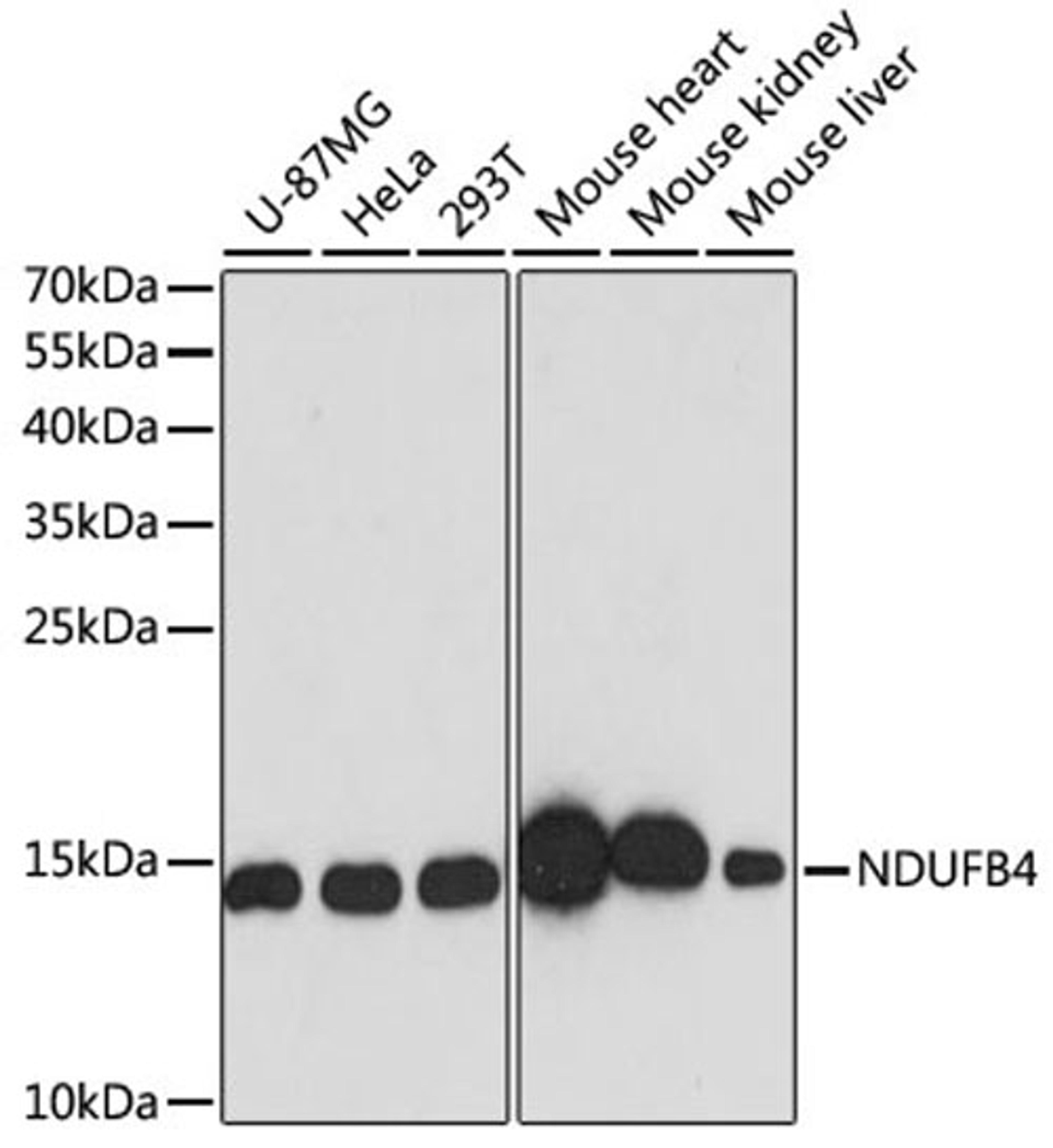 Western blot - NDUFB4 antibody (A13820)