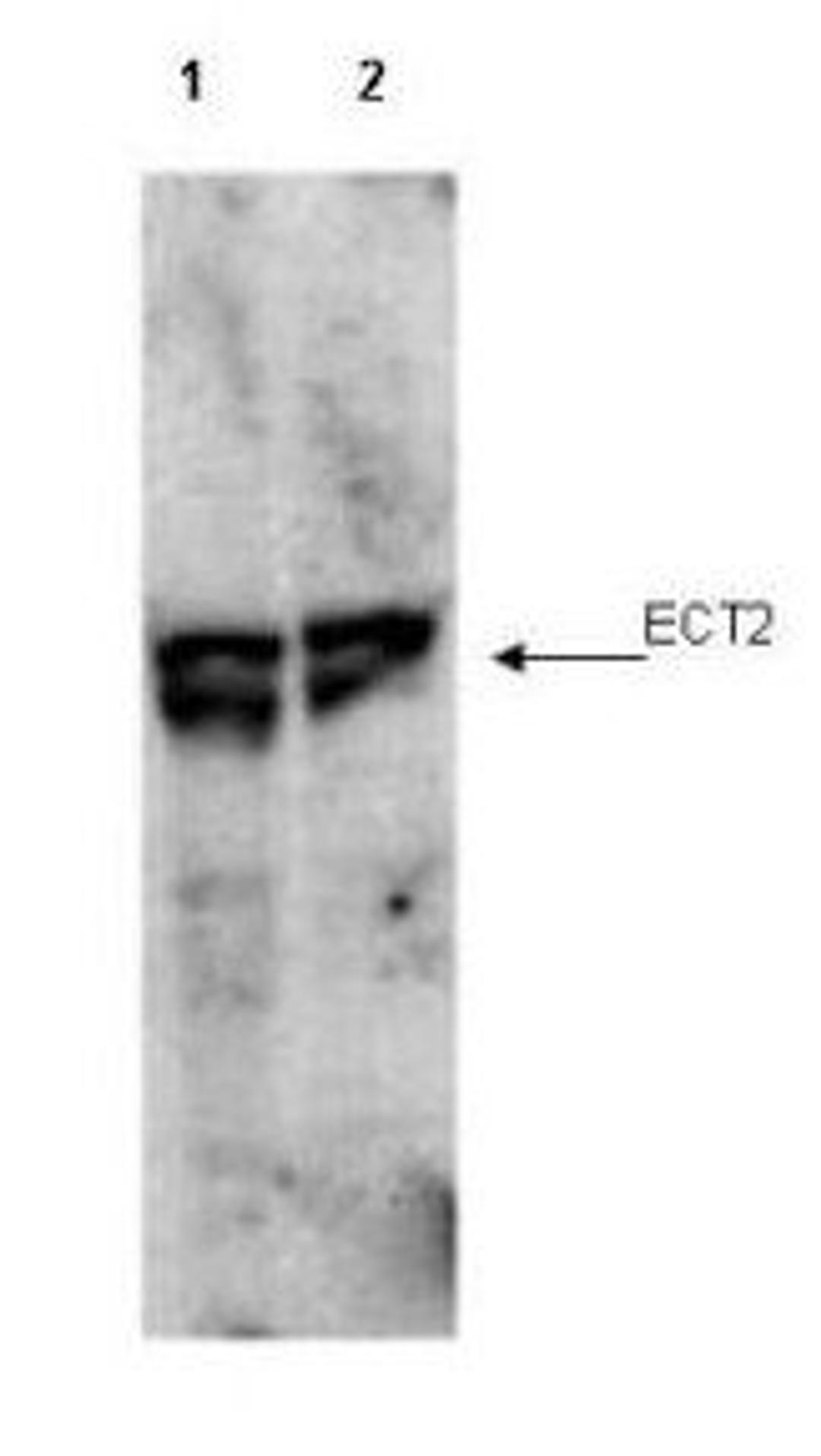 Western blot analysis of present in cell lysates from interphase (lane 1) and mitotic (lane 2) HeLa cells using ECT2 (phospho-T790) antibody