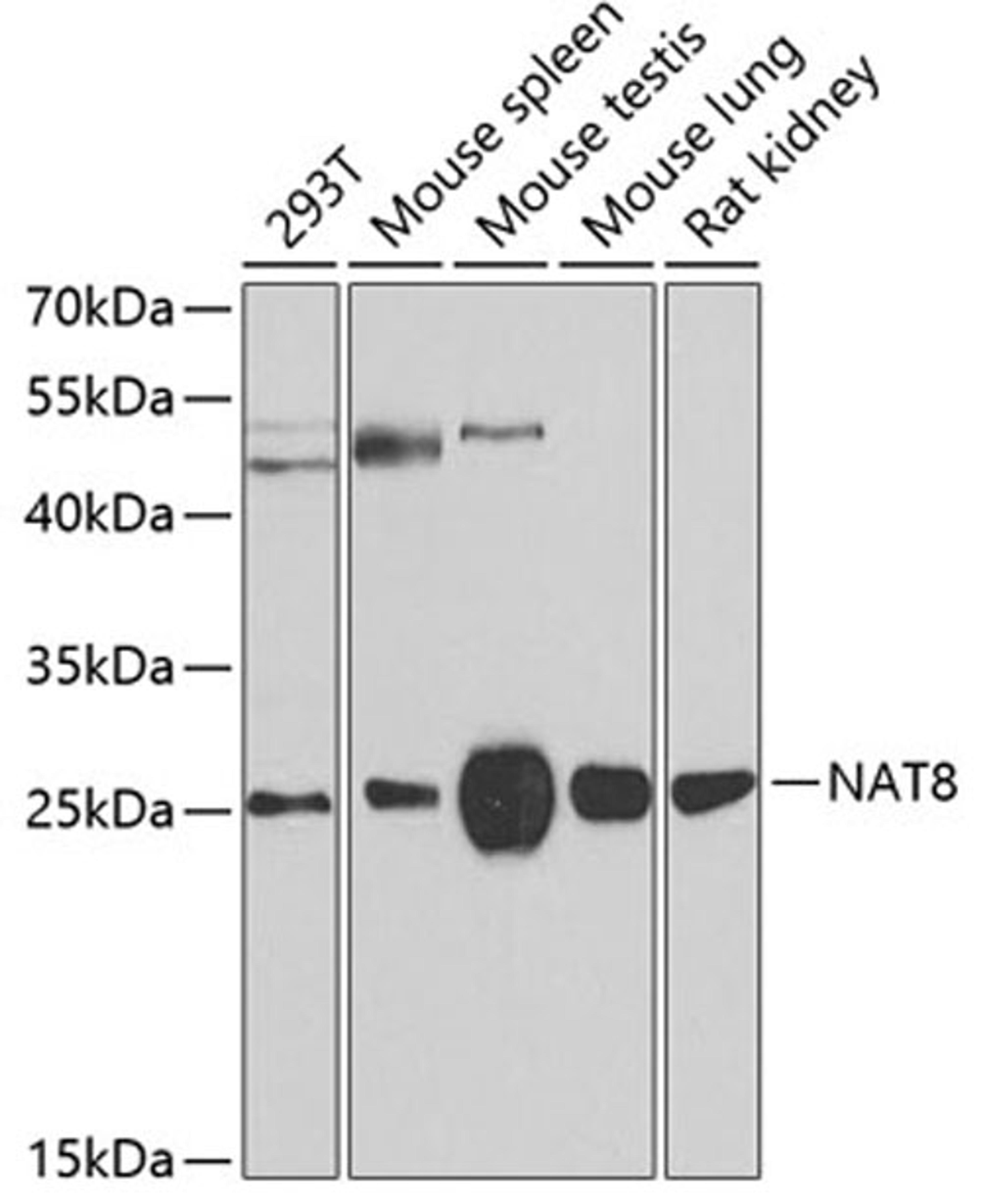 Western blot - NAT8 antibody (A7759)