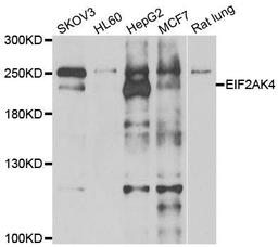 Western blot analysis of extracts of various cell lines using EIF2AK4 antibody