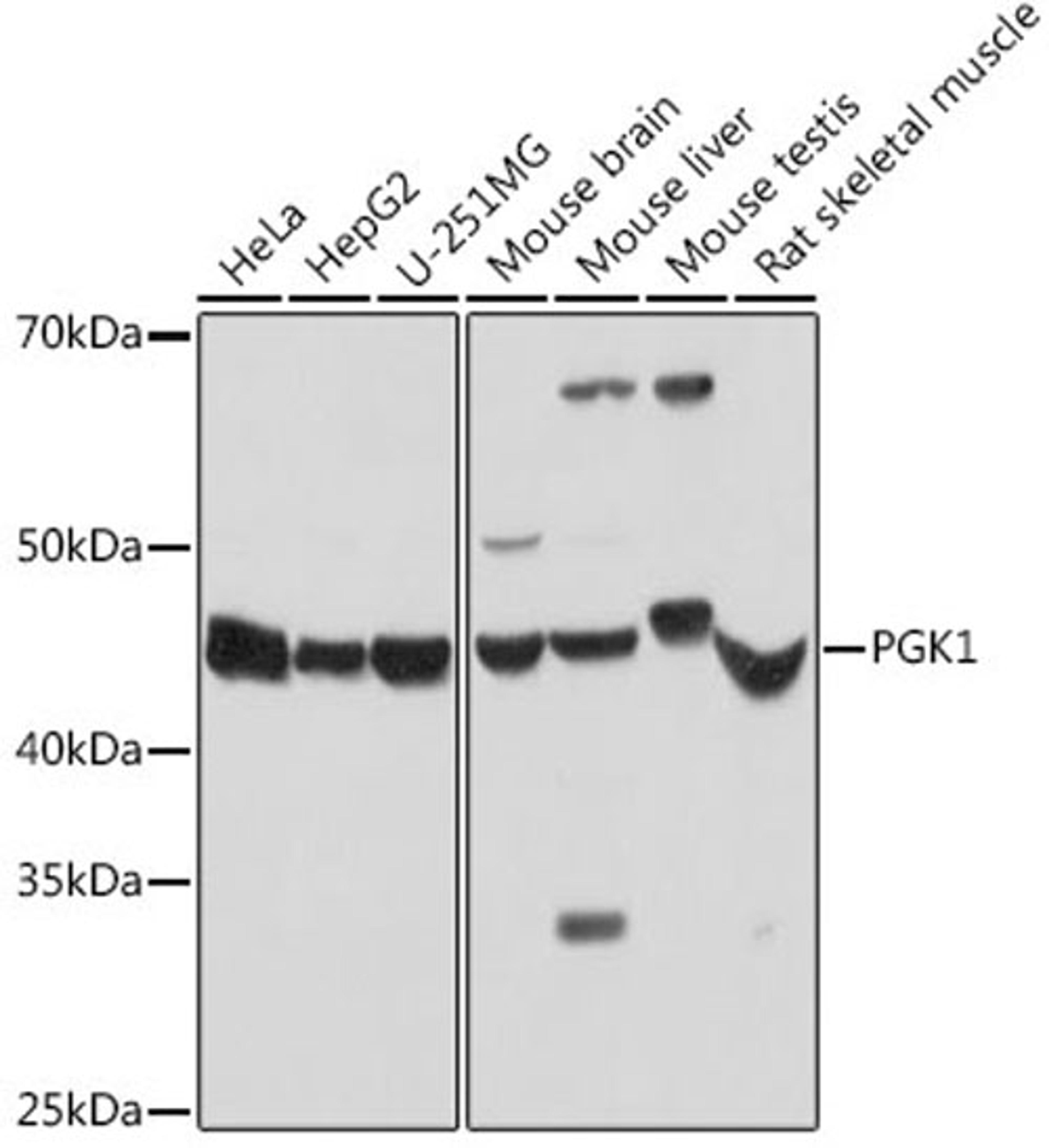 Western blot - PGK1 antibody (A14039)