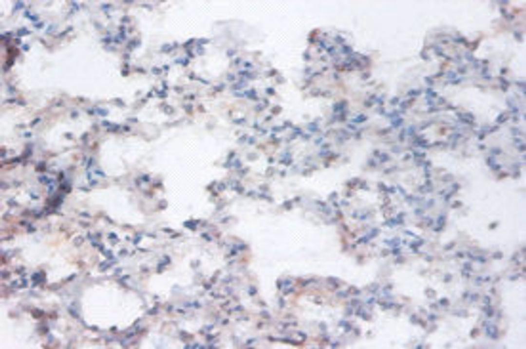 Immunohistochemistry of paraffin-embedded human lung tissue using CSB-PA03465A0Rb at dilution of 1:100