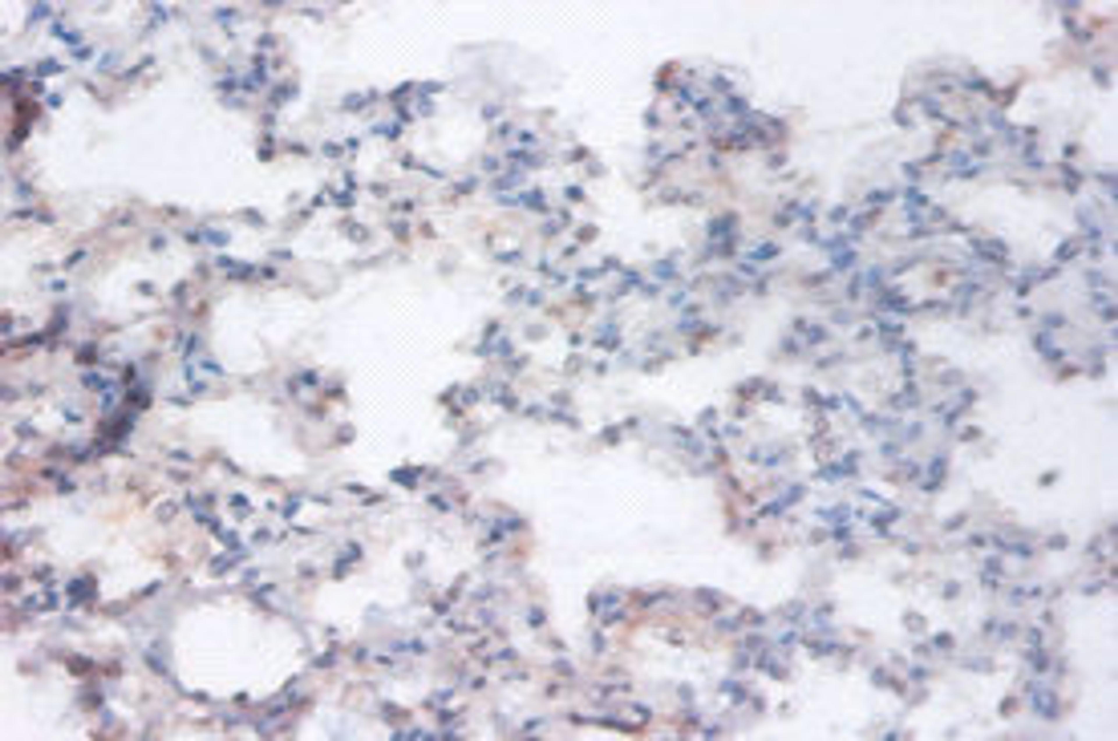 Immunohistochemistry of paraffin-embedded human lung tissue using CSB-PA03465A0Rb at dilution of 1:100