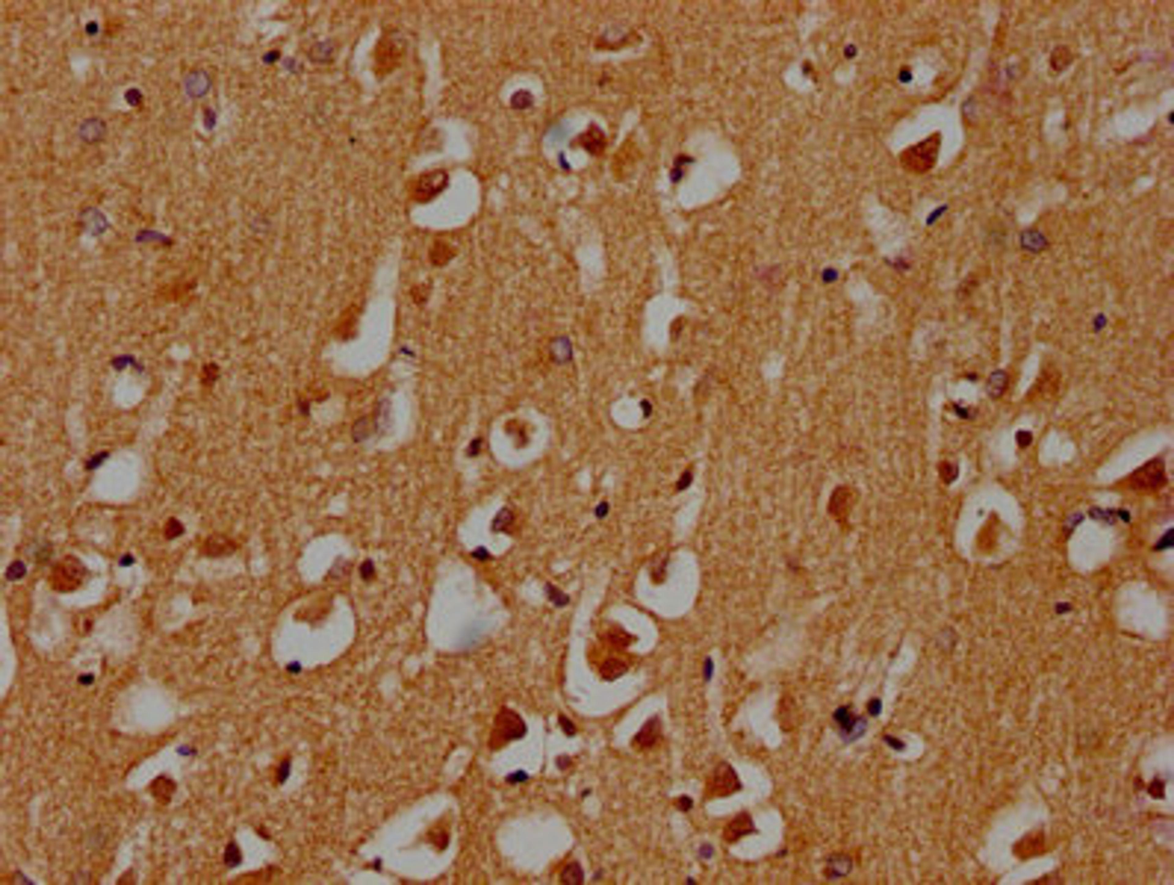 IHC image of CSB-PA722568LA01HU diluted at 1:300 and staining in paraffin-embedded human brain tissue performed on a Leica BondTM system. After dewaxing and hydration, antigen retrieval was mediated by high pressure in a citrate buffer (pH 6.0). Section was blocked with 10% normal goat serum 30min at RT. Then primary antibody (1% BSA) was incubated at 4°C overnight. The primary is detected by a biotinylated secondary antibody and visualized using an HRP conjugated SP system.