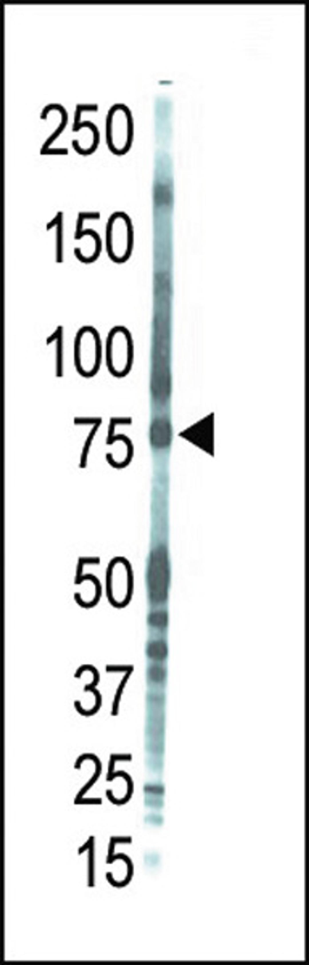 Western blot analysis of anti-PKC theta Pab in placenta lysate. PKC theta was detected using purified Pab.