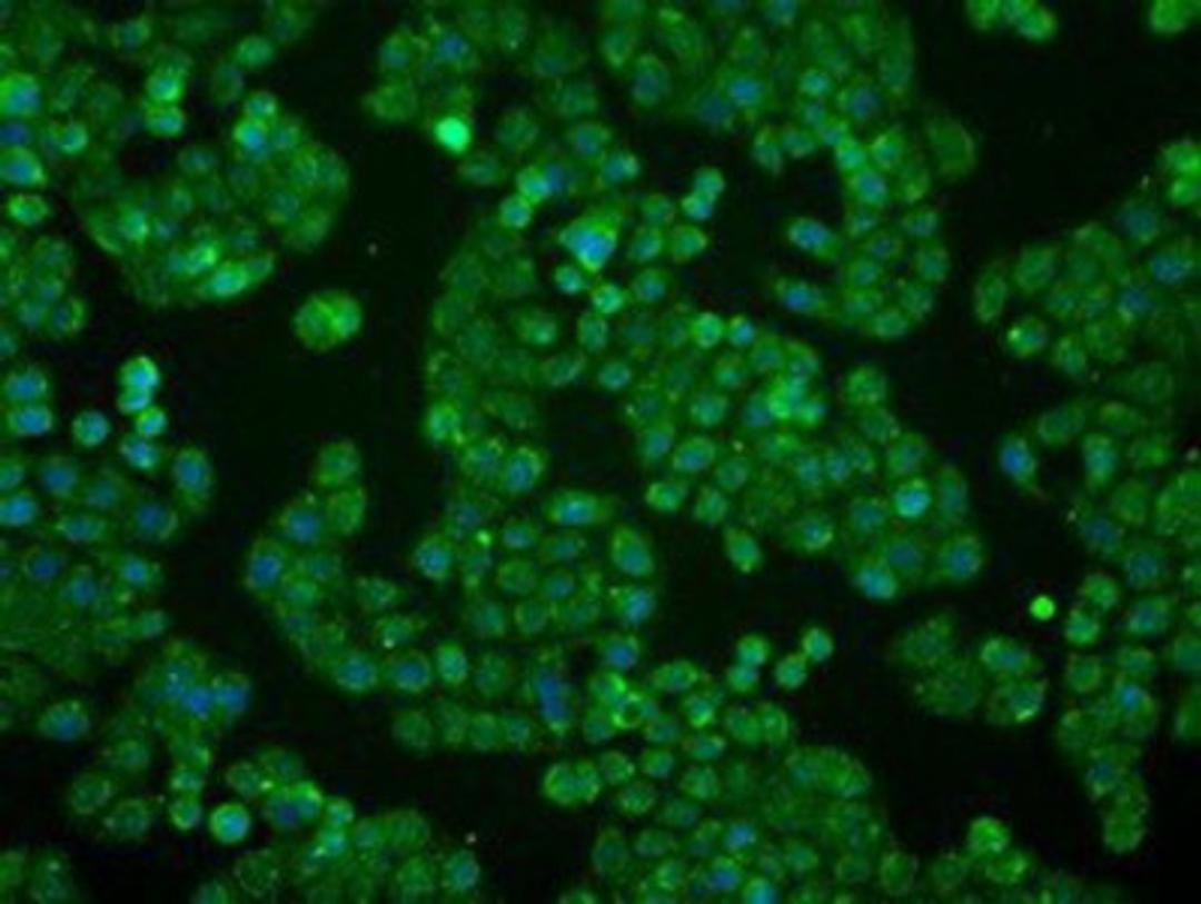 Immunocytochemistry/Immunofluorescence: BTN3A2 Antibody (1A6) [NBP2-02151] - Immunofluorescent staining of HT29 cells using anti-BTN3A2mouse monoclonal antibody.