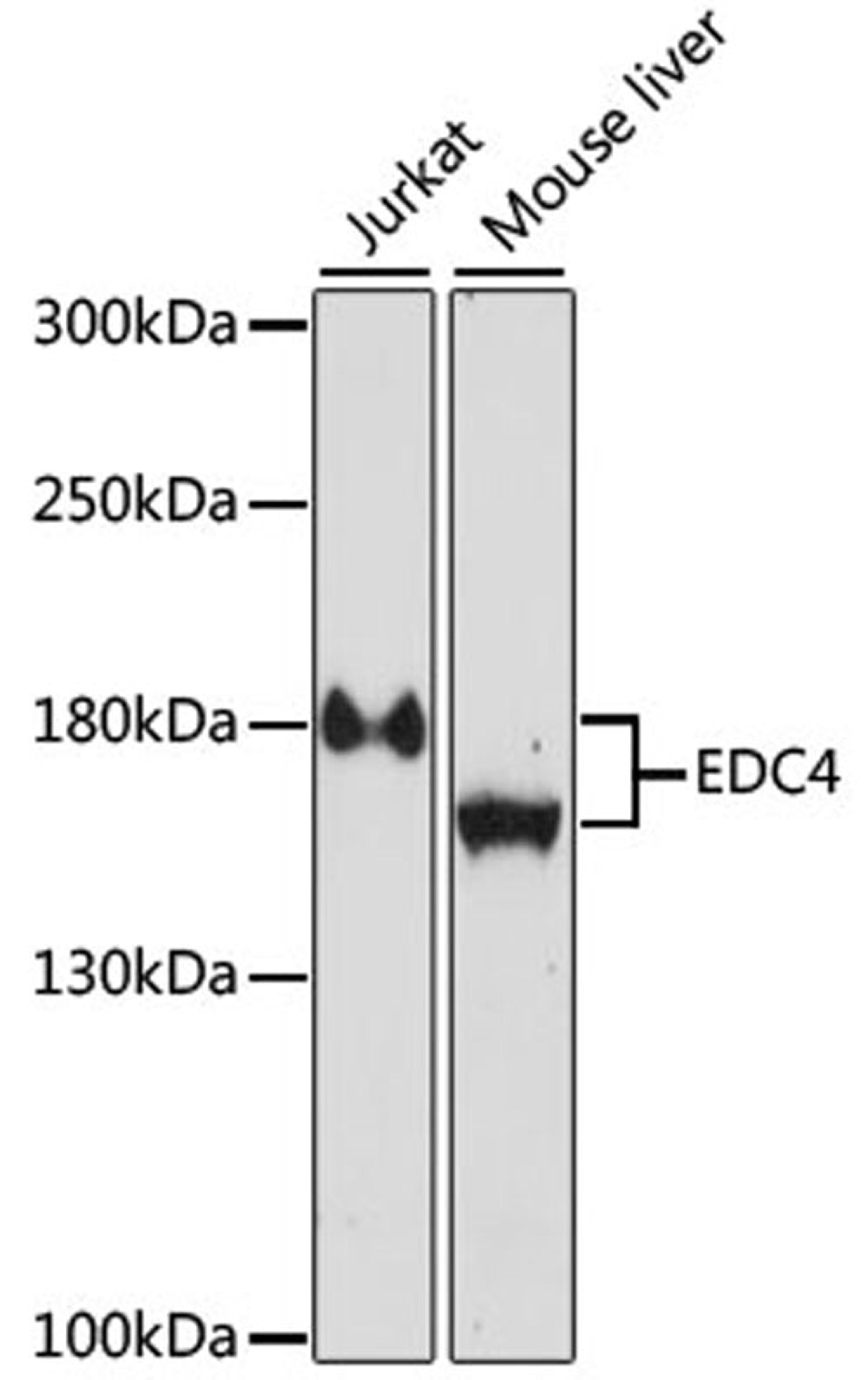 Western blot - EDC4 antibody (A15418)