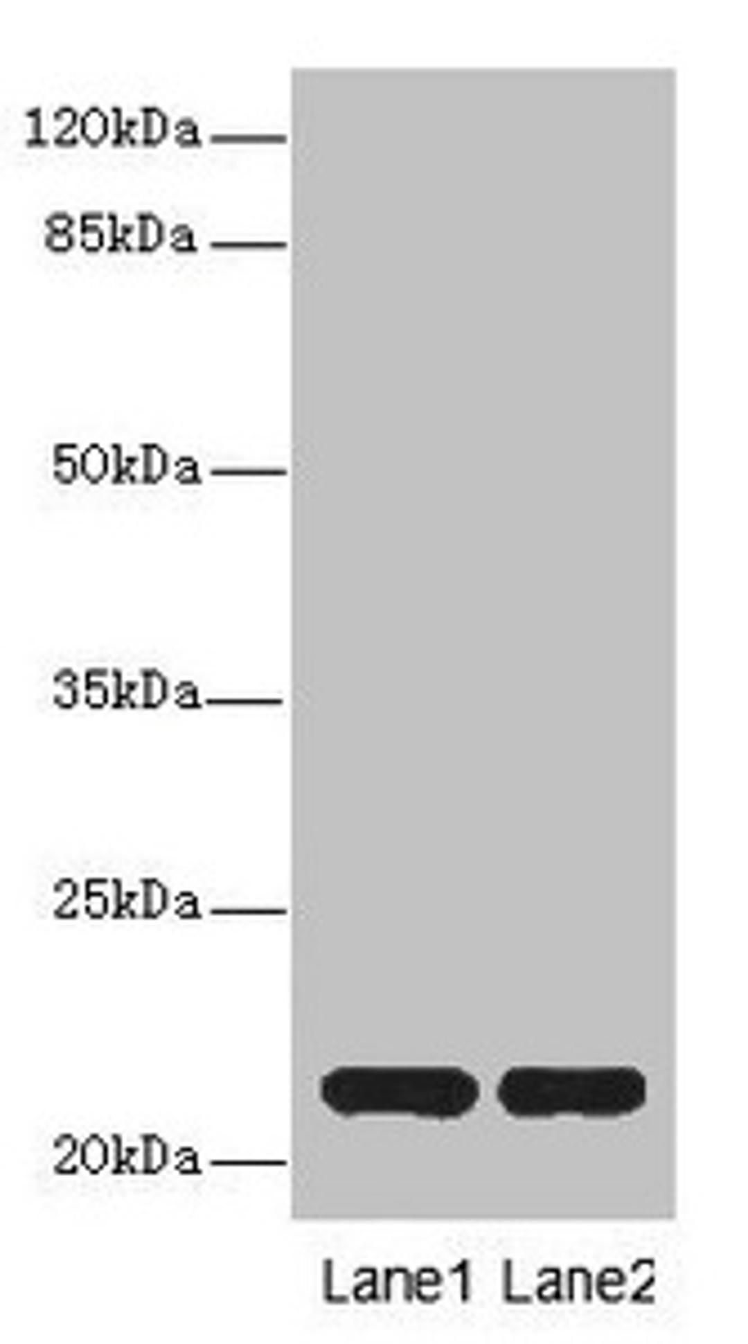 Western blot. All lanes: CXXC4antibody at 3.6ug/ml. Lane 1: Mouse liver tissue. Lane 2: Mouse kidney tissue. Secondary. Goat polyclonal to rabbit IgG at 1/10000 dilution. Predicted band size: 21 kDa. Observed band size: 21 kDa. 