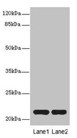 Western blot. All lanes: CXXC4antibody at 3.6ug/ml. Lane 1: Mouse liver tissue. Lane 2: Mouse kidney tissue. Secondary. Goat polyclonal to rabbit IgG at 1/10000 dilution. Predicted band size: 21 kDa. Observed band size: 21 kDa. 
