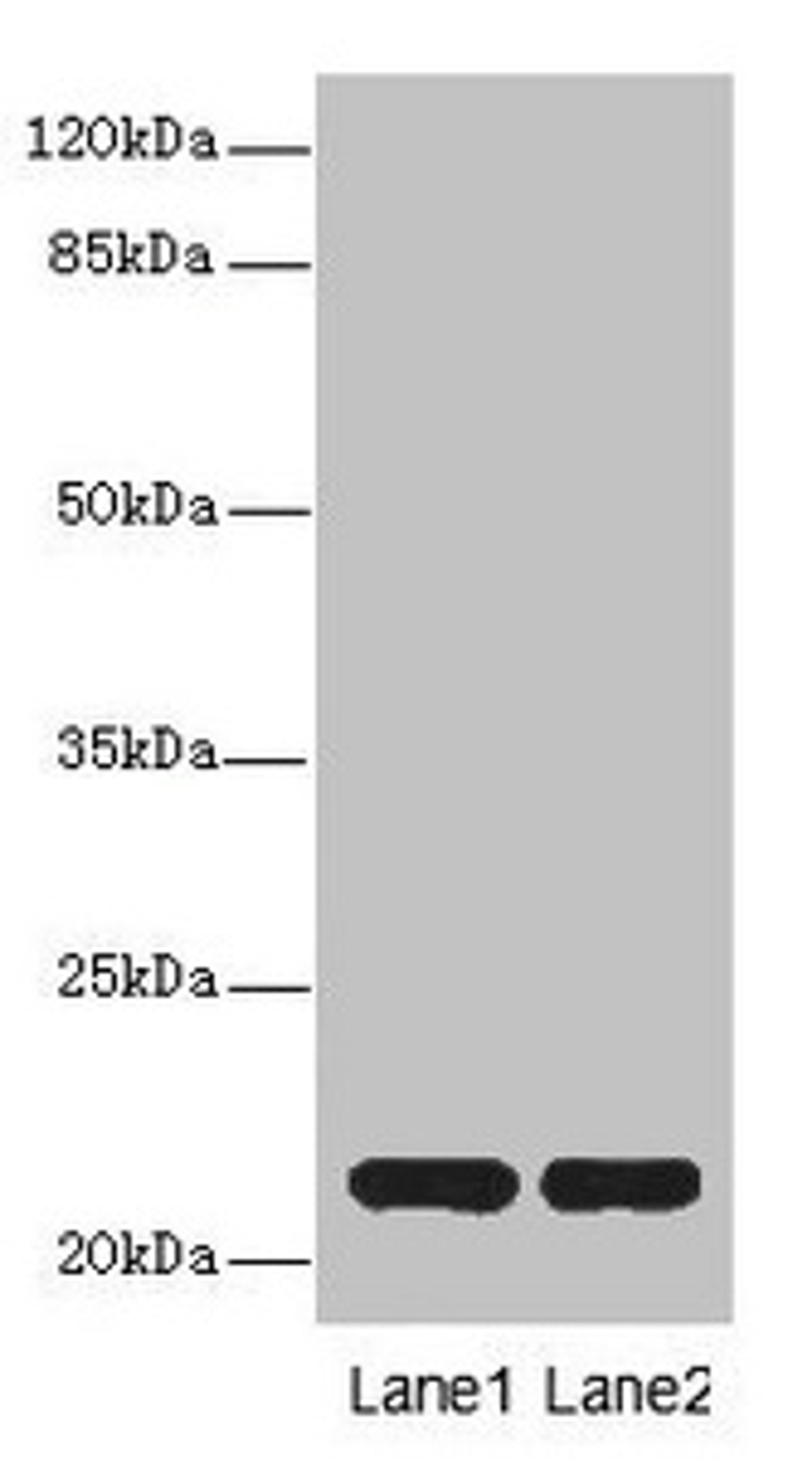 Western blot. All lanes: CXXC4antibody at 3.6ug/ml. Lane 1: Mouse liver tissue. Lane 2: Mouse kidney tissue. Secondary. Goat polyclonal to rabbit IgG at 1/10000 dilution. Predicted band size: 21 kDa. Observed band size: 21 kDa. 