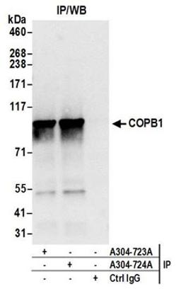 Detection of human COPB1 by western blot of immunoprecipitates.