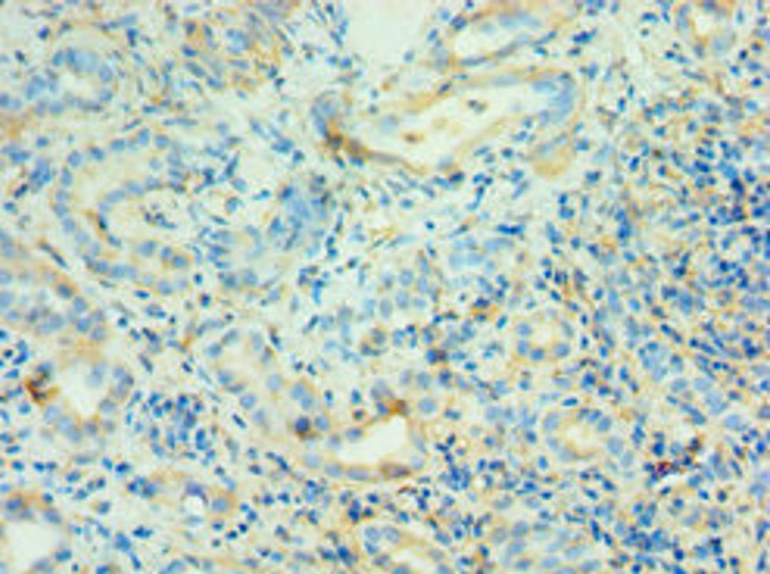 Immunohistochemistry of paraffin-embedded human kidney tissue using CSB-PA001463ESR1HU at dilution of 1:100