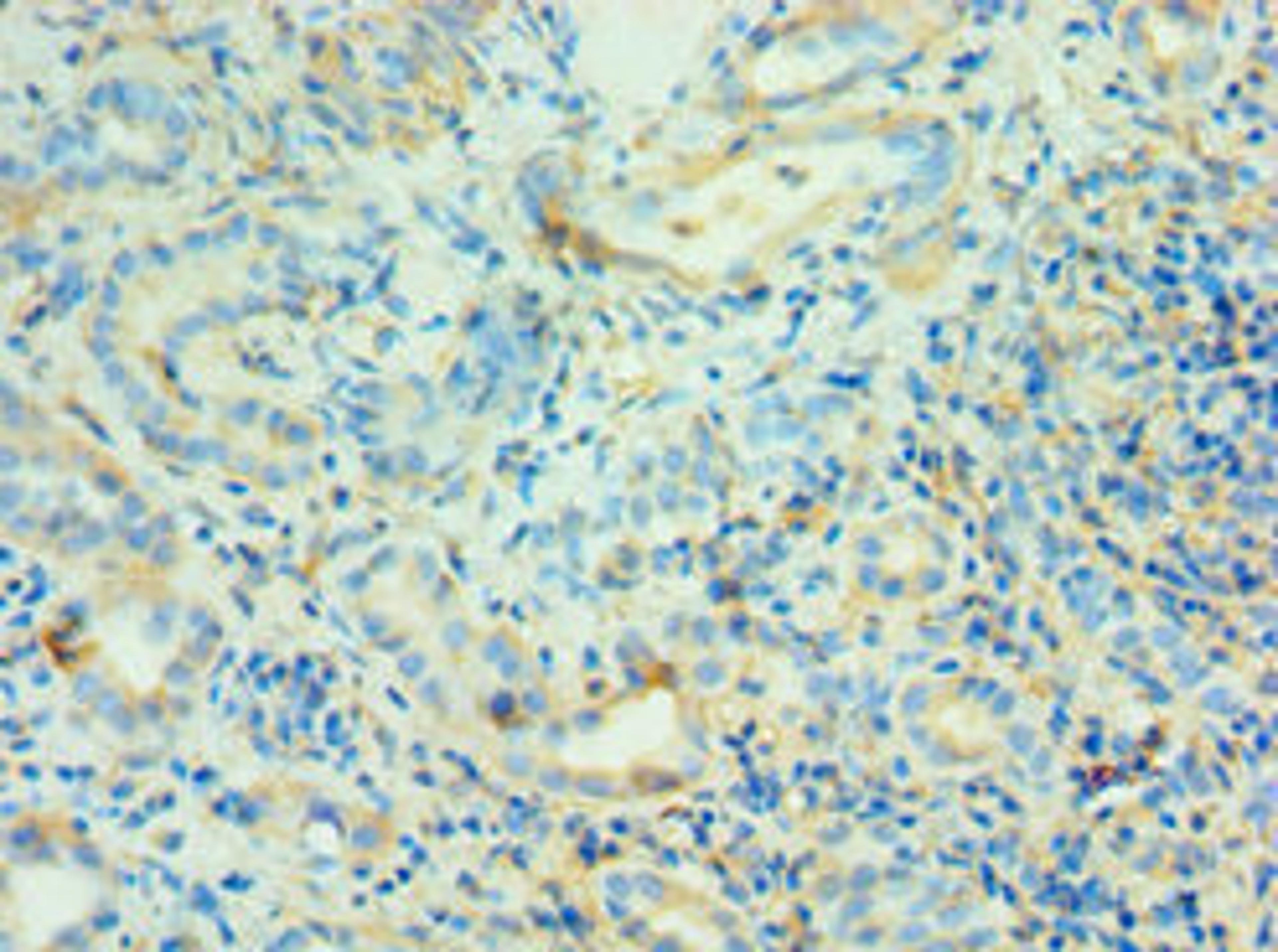Immunohistochemistry of paraffin-embedded human kidney tissue using CSB-PA001463ESR1HU at dilution of 1:100