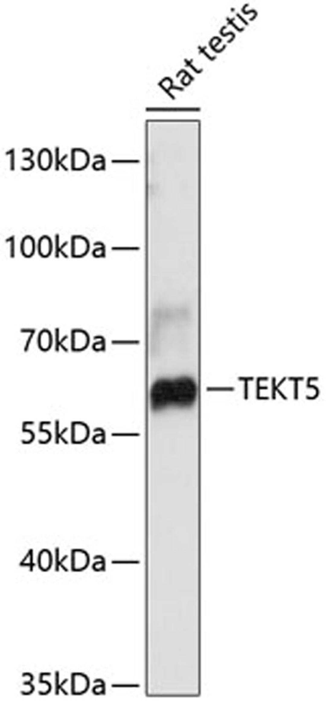 Western blot - TEKT5 antibody (A12377)