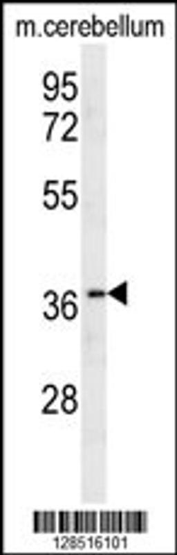 Western blot analysis in mouse cerebellum tissue lysates (35ug/lane).