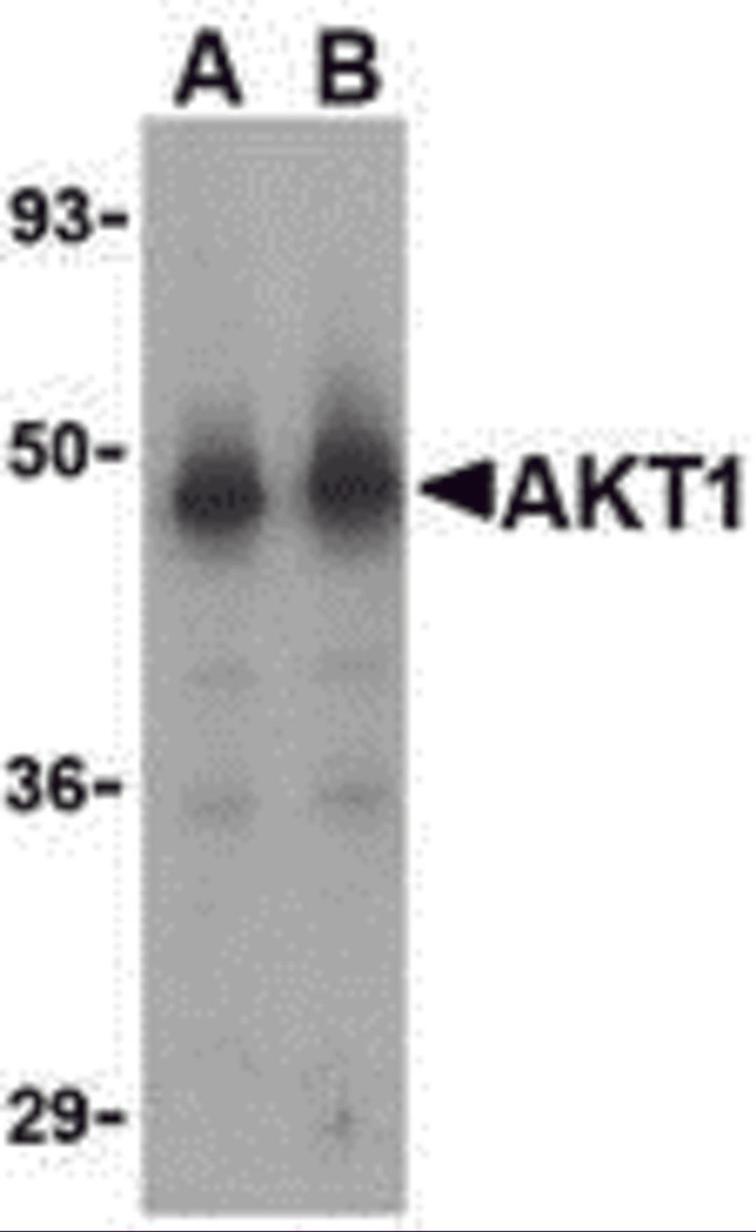 Western blot analysis of Akt1 in human liver cell lysate with Akt1 antibody at (A) 1 and (B) 2 &#956;g/mL.