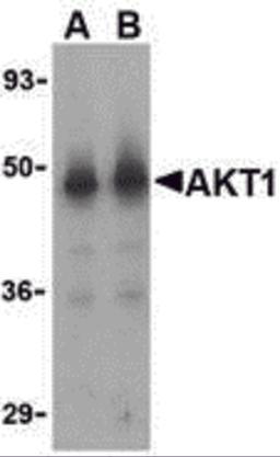 Western blot analysis of Akt1 in human liver cell lysate with Akt1 antibody at (A) 1 and (B) 2 &#956;g/mL.