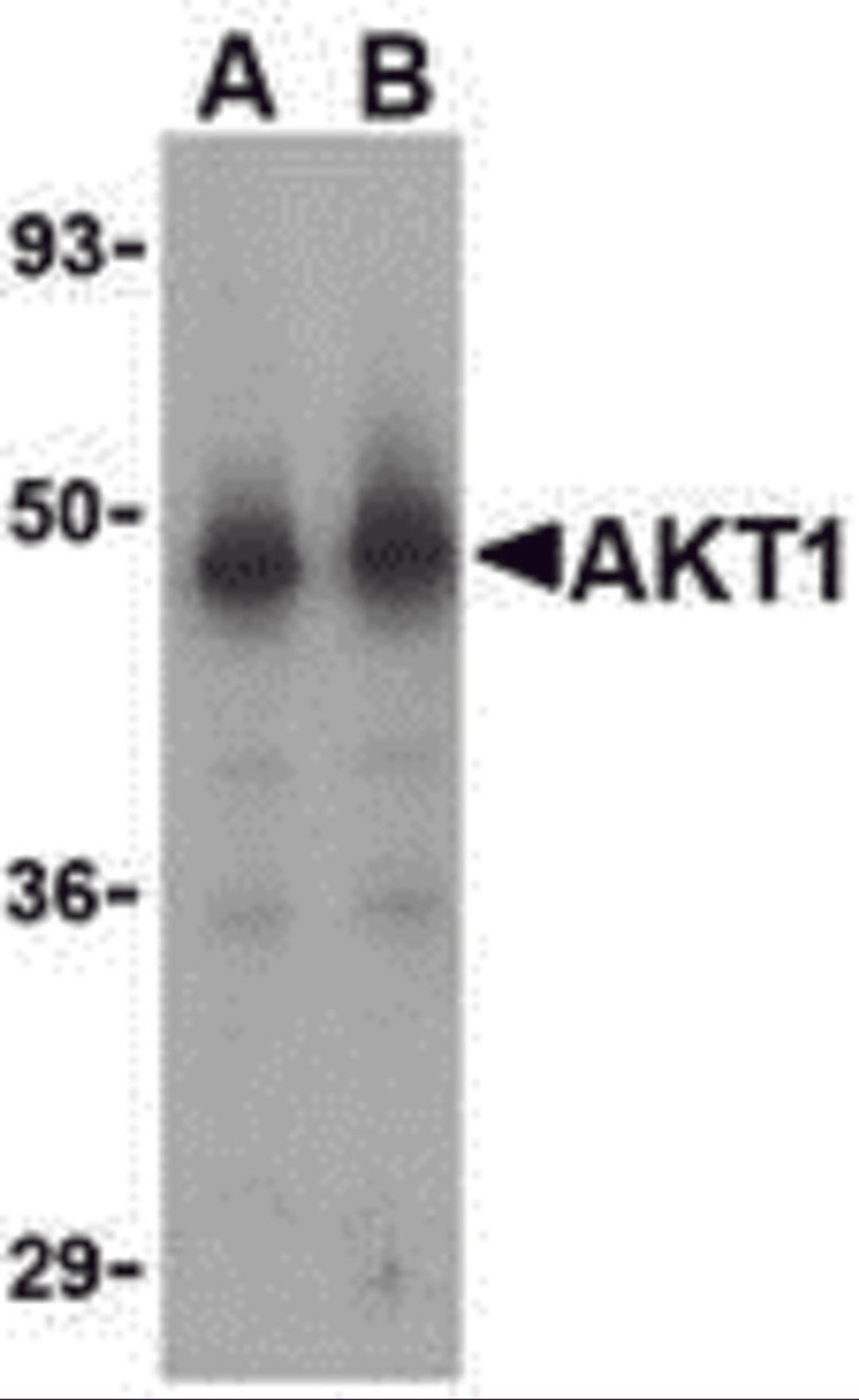 Western blot analysis of Akt1 in human liver cell lysate with Akt1 antibody at (A) 1 and (B) 2 μg/mL.