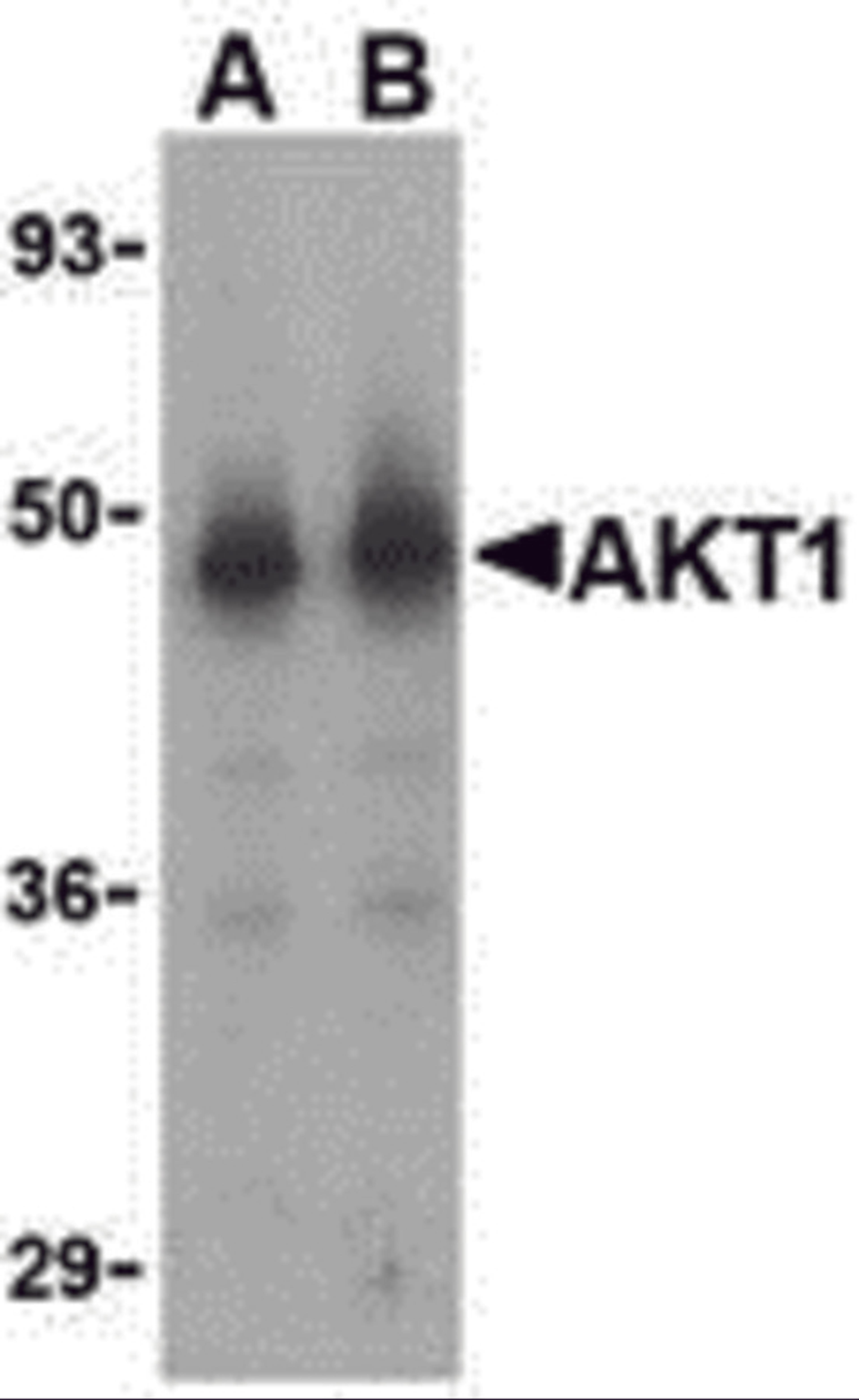 Western blot analysis of Akt1 in human liver cell lysate with Akt1 antibody at (A) 1 and (B) 2 μg/mL.
